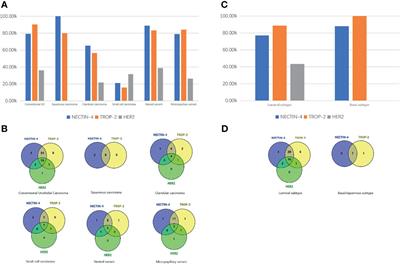 Head-to-Head Comparison of the Expression Differences of NECTIN-4, TROP-2, and HER2 in Urothelial Carcinoma and Its Histologic Variants